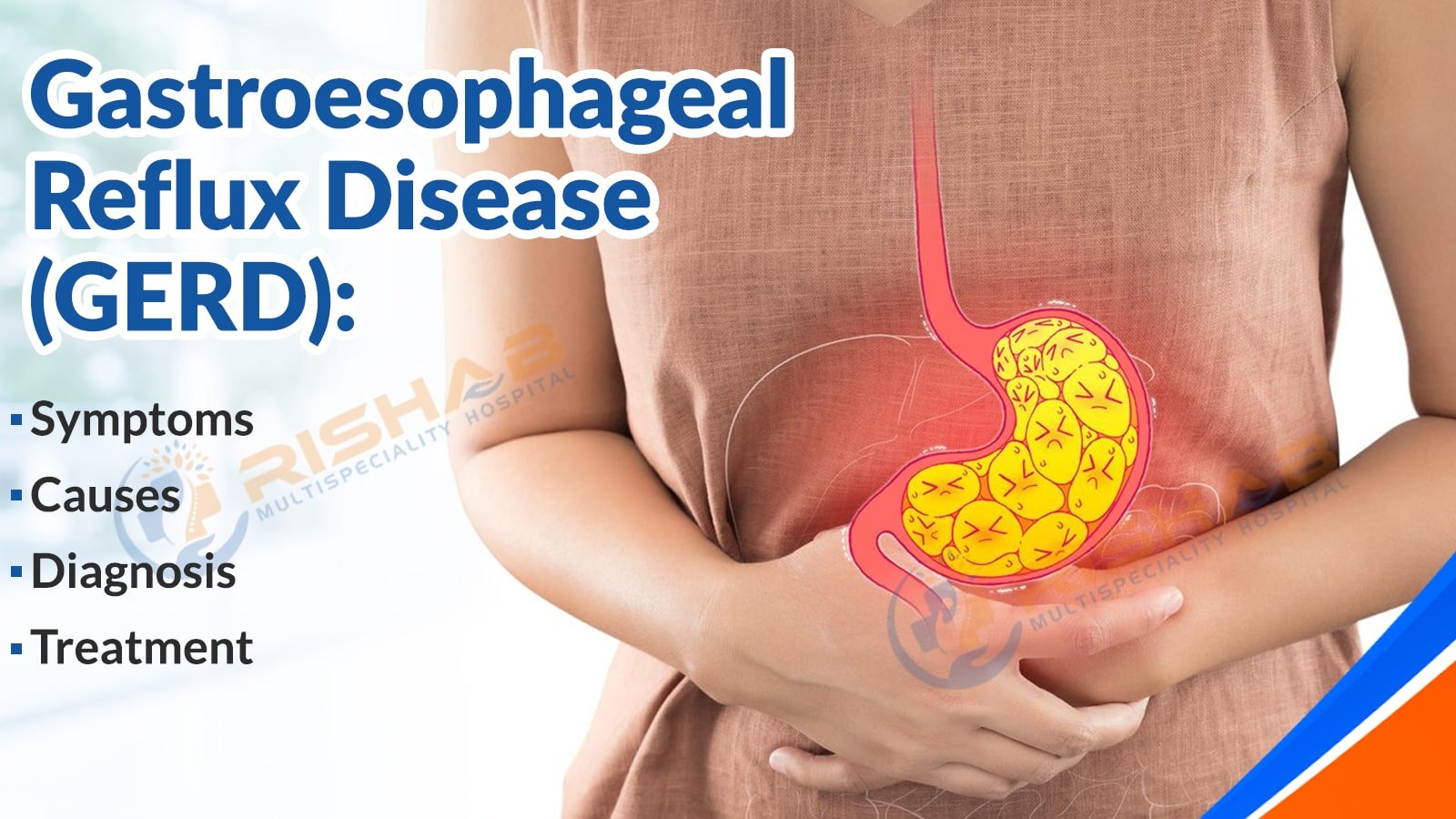 Gastroesophageal Reflux Disease (GERD): Symptoms, Causes, Diagnosis, and Treatment